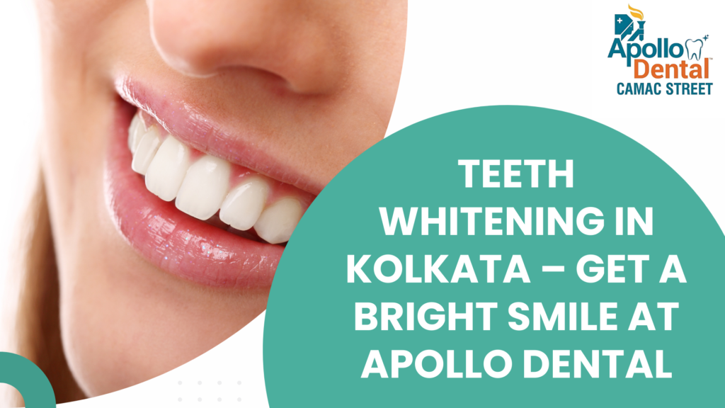 Teeth Whitening in Kolkata